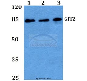 Anti-GIT2 (D391) Antibody from Bioworld Technology (BS2056) - Antibodies.com