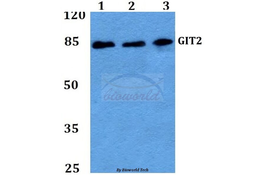 Anti-GIT2 (D391) Antibody from Bioworld Technology (BS2056) - Antibodies.com