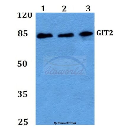 Anti-GIT2 (D391) Antibody from Bioworld Technology (BS2056) - Antibodies.com