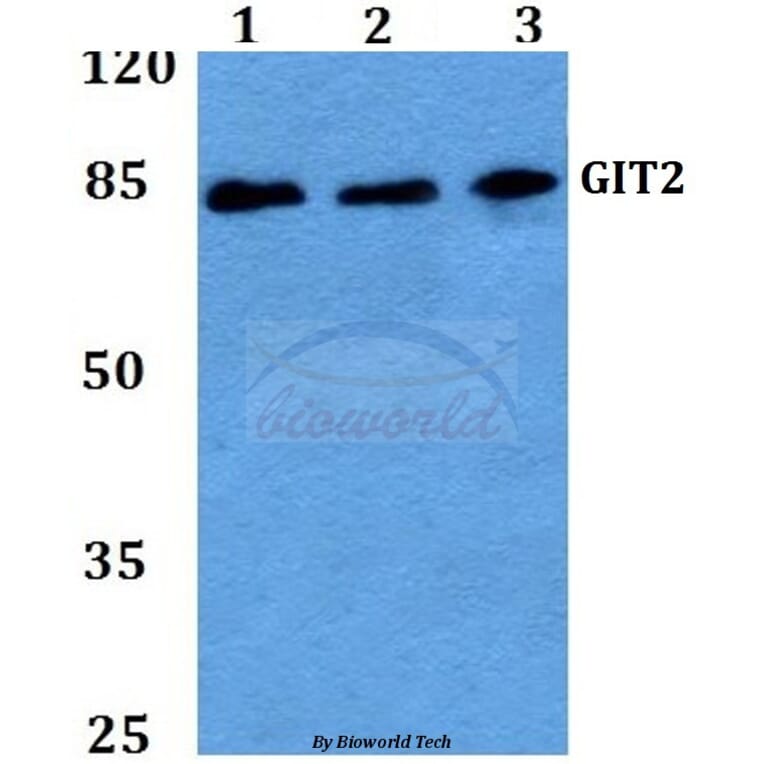 Anti-GIT2 (D391) Antibody from Bioworld Technology (BS2056) - Antibodies.com