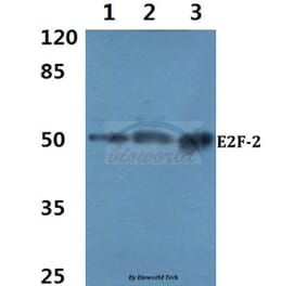 Anti-E2F-2 (K236) Antibody from Bioworld Technology (BS2057) - Antibodies.com