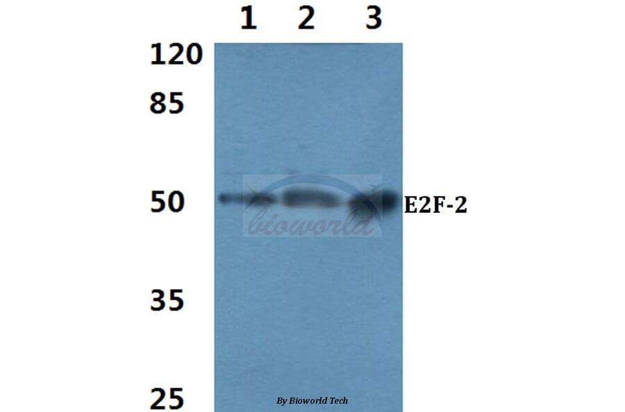 Anti-E2F-2 (K236) Antibody from Bioworld Technology (BS2057) - Antibodies.com