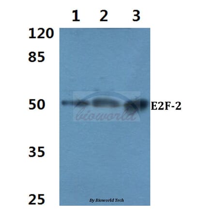 Anti-E2F-2 (K236) Antibody from Bioworld Technology (BS2057) - Antibodies.com