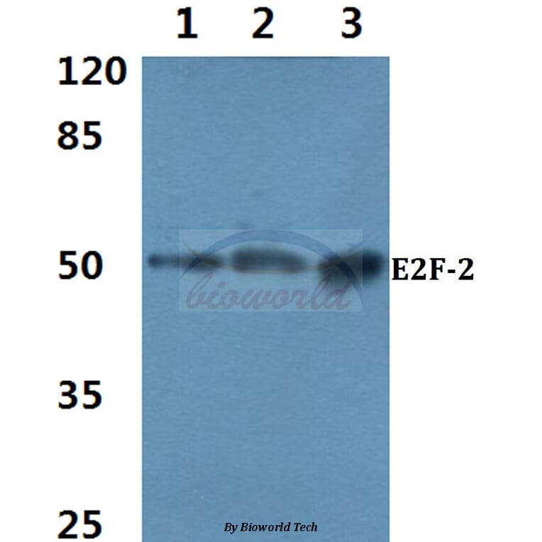 Anti-E2F-2 (K236) Antibody from Bioworld Technology (BS2057) - Antibodies.com