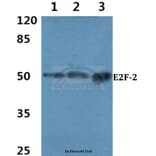 Anti-E2F-2 (K236) Antibody from Bioworld Technology (BS2057) - Antibodies.com