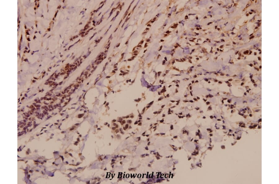 Anti-E2F-2 (K236) Antibody from Bioworld Technology (BS2057) - Antibodies.com
