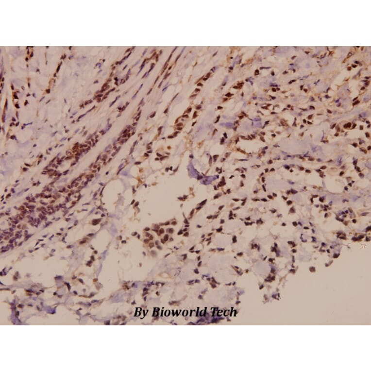 Anti-E2F-2 (K236) Antibody from Bioworld Technology (BS2057) - Antibodies.com