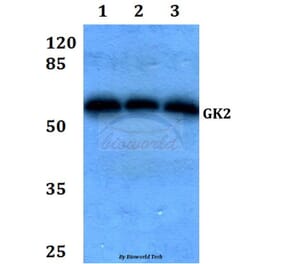 Anti-GK2 (Y306) Antibody from Bioworld Technology (BS2060) - Antibodies.com