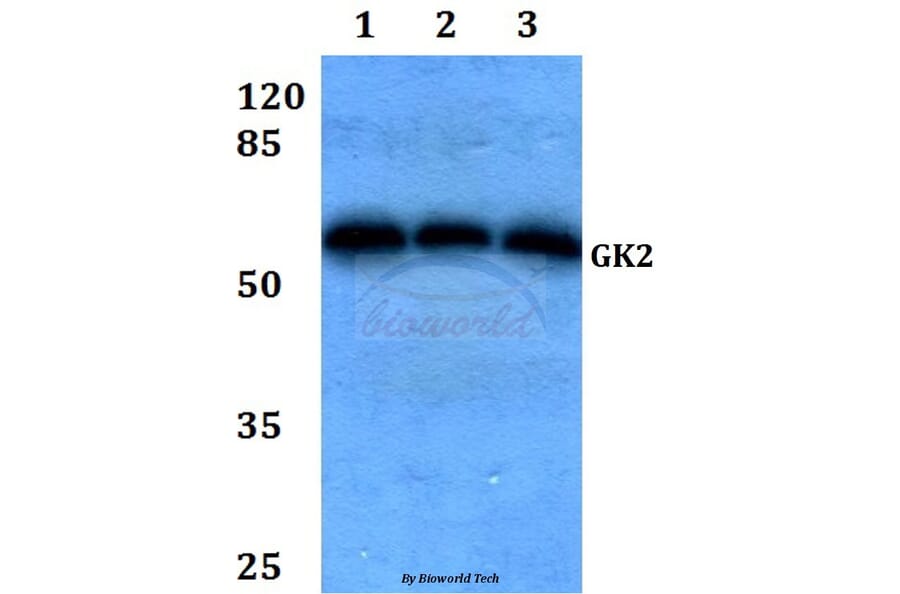 Anti-GK2 (Y306) Antibody from Bioworld Technology (BS2060) - Antibodies.com