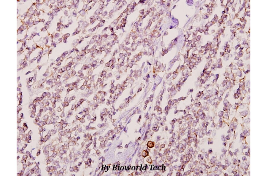 Anti-GK2 (Y306) Antibody from Bioworld Technology (BS2060) - Antibodies.com