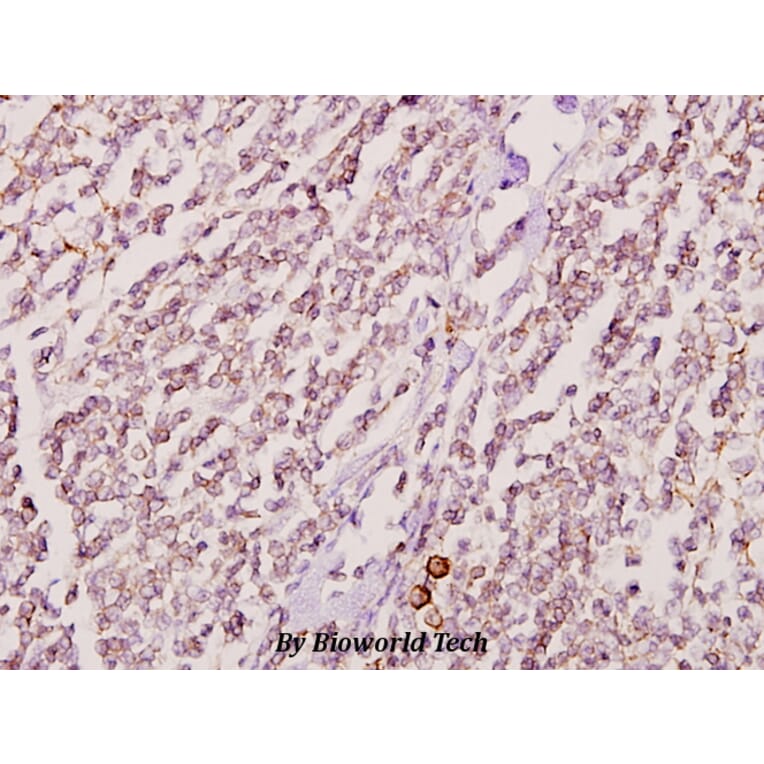 Anti-GK2 (Y306) Antibody from Bioworld Technology (BS2060) - Antibodies.com