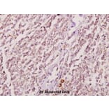 Anti-GK2 (Y306) Antibody from Bioworld Technology (BS2060) - Antibodies.com