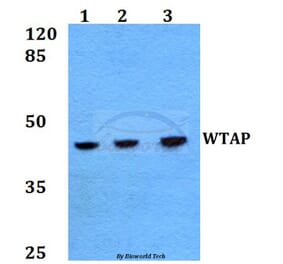 Anti-WTAP (H351) Antibody from Bioworld Technology (BS2062) - Antibodies.com