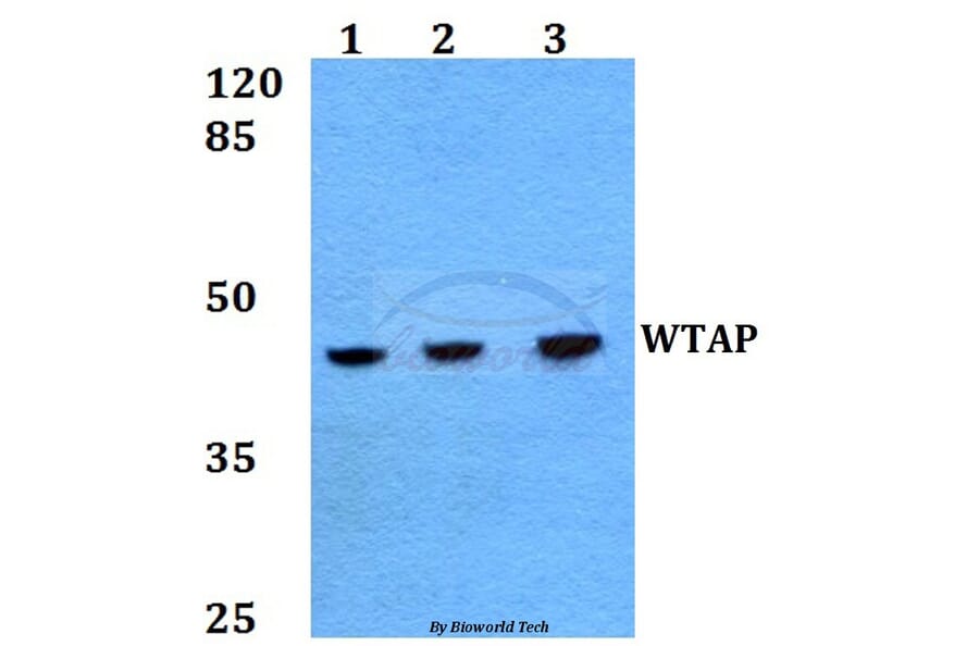 Anti-WTAP (H351) Antibody from Bioworld Technology (BS2062) - Antibodies.com