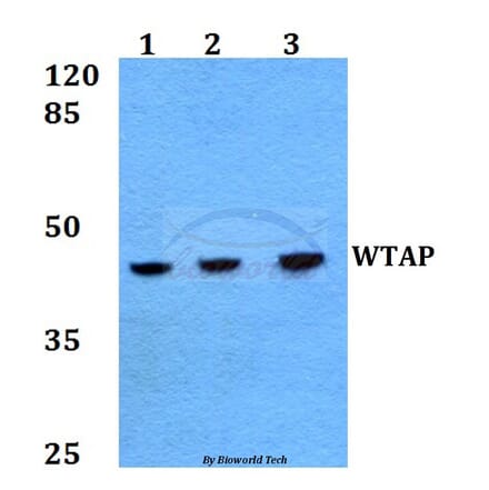 Anti-WTAP (H351) Antibody from Bioworld Technology (BS2062) - Antibodies.com