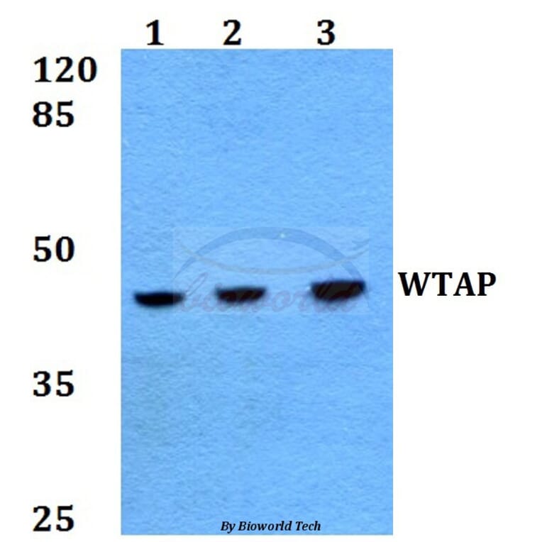 Anti-WTAP (H351) Antibody from Bioworld Technology (BS2062) - Antibodies.com
