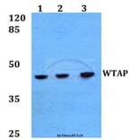 Anti-WTAP (H351) Antibody from Bioworld Technology (BS2062) - Antibodies.com