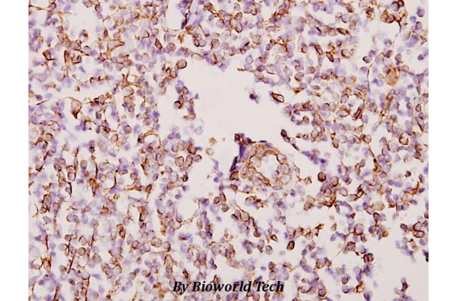 Anti-WTAP (H351) Antibody from Bioworld Technology (BS2062) - Antibodies.com