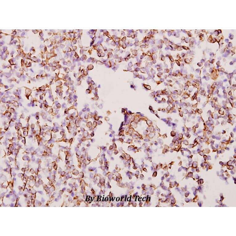 Anti-WTAP (H351) Antibody from Bioworld Technology (BS2062) - Antibodies.com