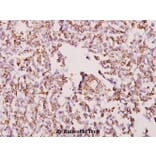 Anti-WTAP (H351) Antibody from Bioworld Technology (BS2062) - Antibodies.com