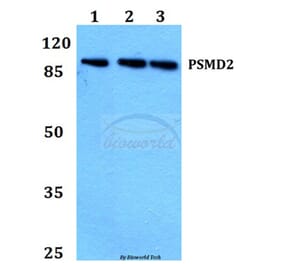 Anti-PSMD2 (R34) Antibody from Bioworld Technology (BS2063) - Antibodies.com