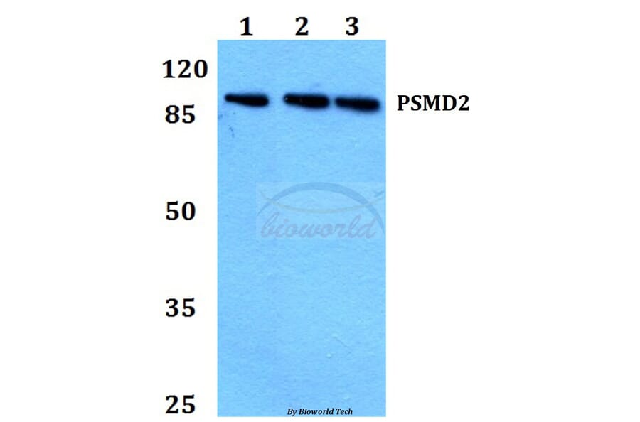 Anti-PSMD2 (R34) Antibody from Bioworld Technology (BS2063) - Antibodies.com