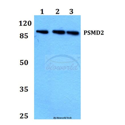 Anti-PSMD2 (R34) Antibody from Bioworld Technology (BS2063) - Antibodies.com