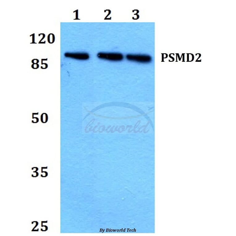 Anti-PSMD2 (R34) Antibody from Bioworld Technology (BS2063) - Antibodies.com