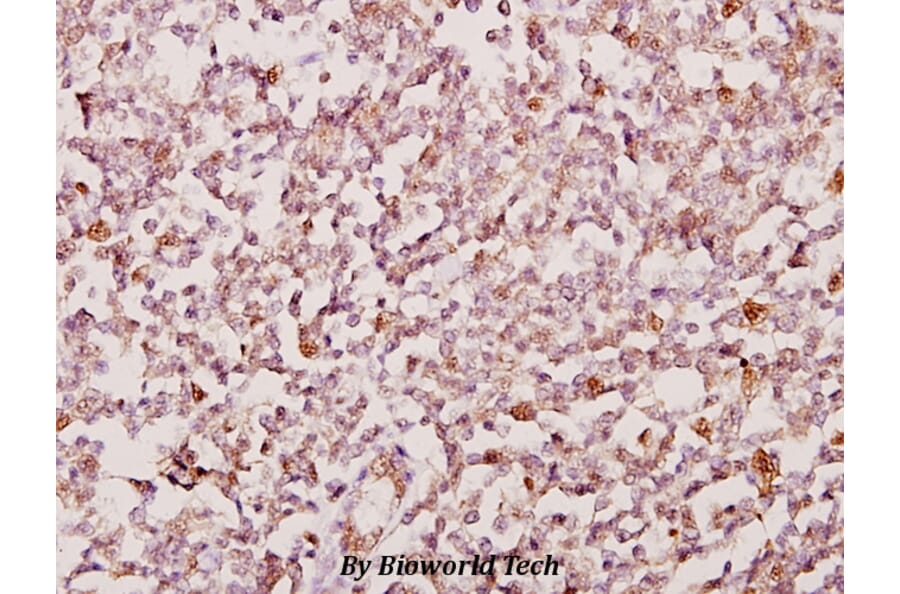 Anti-PSMD2 (R34) Antibody from Bioworld Technology (BS2063) - Antibodies.com
