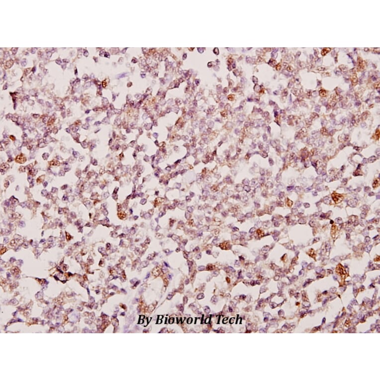 Anti-PSMD2 (R34) Antibody from Bioworld Technology (BS2063) - Antibodies.com