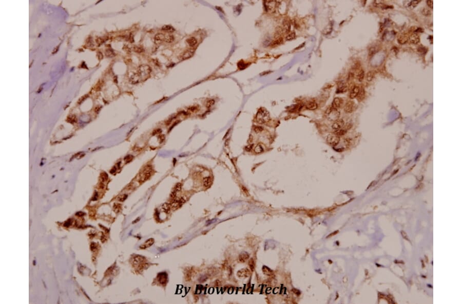 Anti-BRD3 (F645) Antibody from Bioworld Technology (BS2064) - Antibodies.com