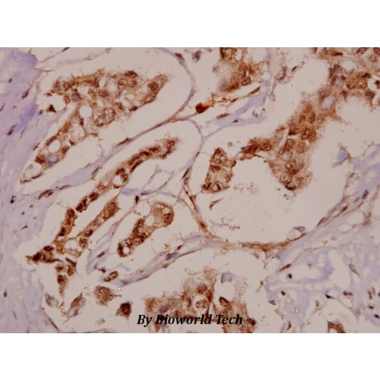Anti-BRD3 (F645) Antibody from Bioworld Technology (BS2064) - Antibodies.com