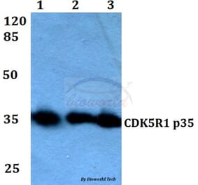 Anti-CDK5R1 (Q31) Antibody from Bioworld Technology (BS2065) - Antibodies.com