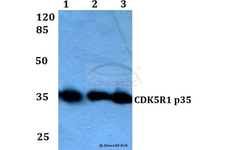 Anti-CDK5R1 (Q31) Antibody from Bioworld Technology (BS2065) - Antibodies.com