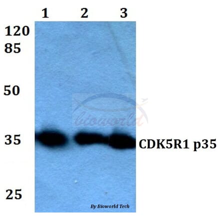 Anti-CDK5R1 (Q31) Antibody from Bioworld Technology (BS2065) - Antibodies.com