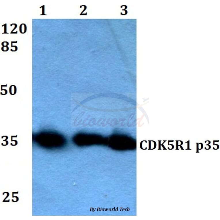 Anti-CDK5R1 (Q31) Antibody from Bioworld Technology (BS2065) - Antibodies.com