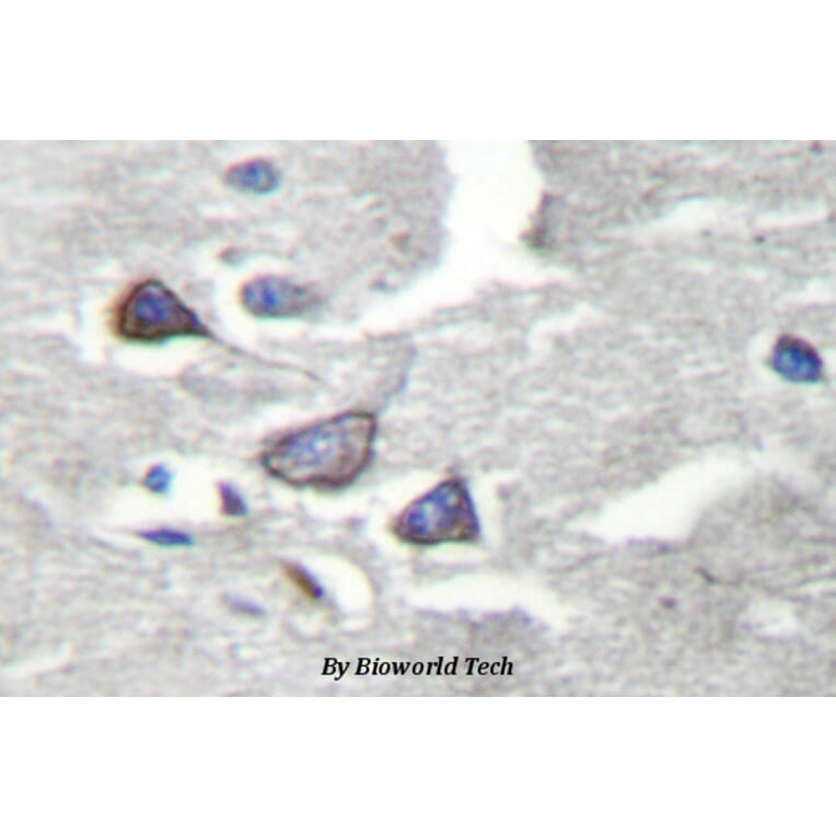 Anti-CDK5R1 (Q31) Antibody from Bioworld Technology (BS2065) - Antibodies.com