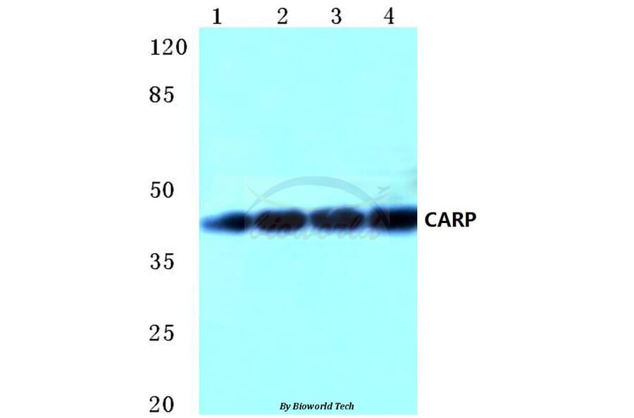 Anti-CARP (A243) Antibody from Bioworld Technology (BS2066) - Antibodies.com