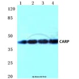 Anti-CARP (A243) Antibody from Bioworld Technology (BS2066) - Antibodies.com