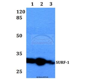 Anti-SURF-1 (F181) Antibody from Bioworld Technology (BS2068) - Antibodies.com