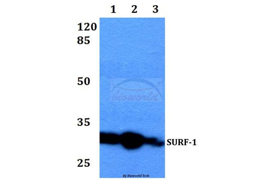 Anti-SURF-1 (F181) Antibody from Bioworld Technology (BS2068) - Antibodies.com