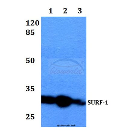 Anti-SURF-1 (F181) Antibody from Bioworld Technology (BS2068) - Antibodies.com