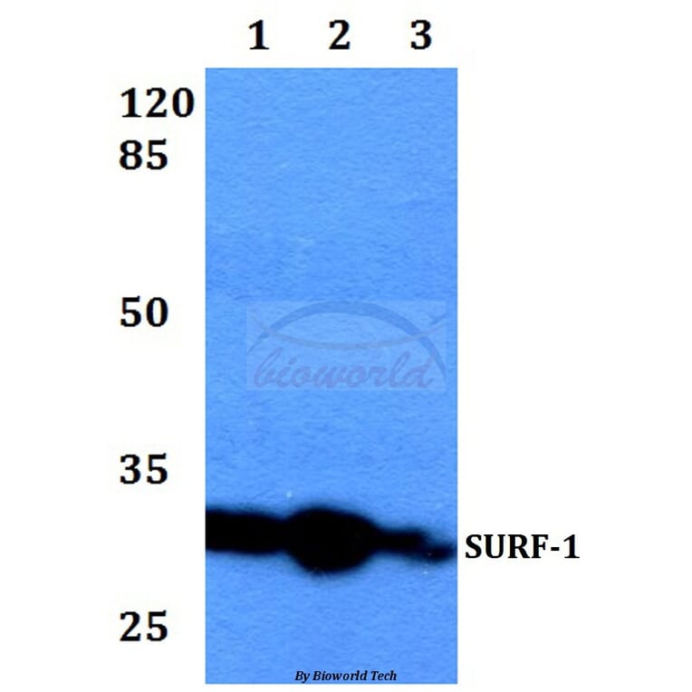 Anti-SURF-1 (F181) Antibody from Bioworld Technology (BS2068) - Antibodies.com