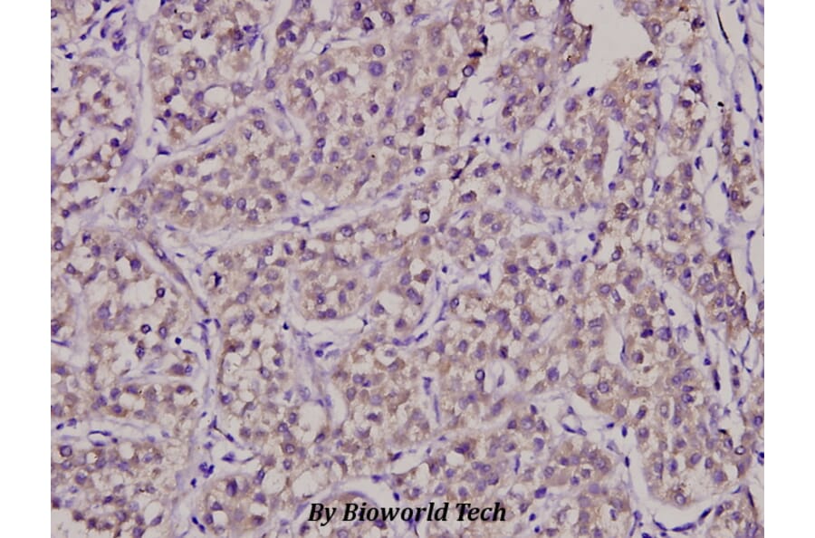 Anti-SURF-1 (F181) Antibody from Bioworld Technology (BS2068) - Antibodies.com