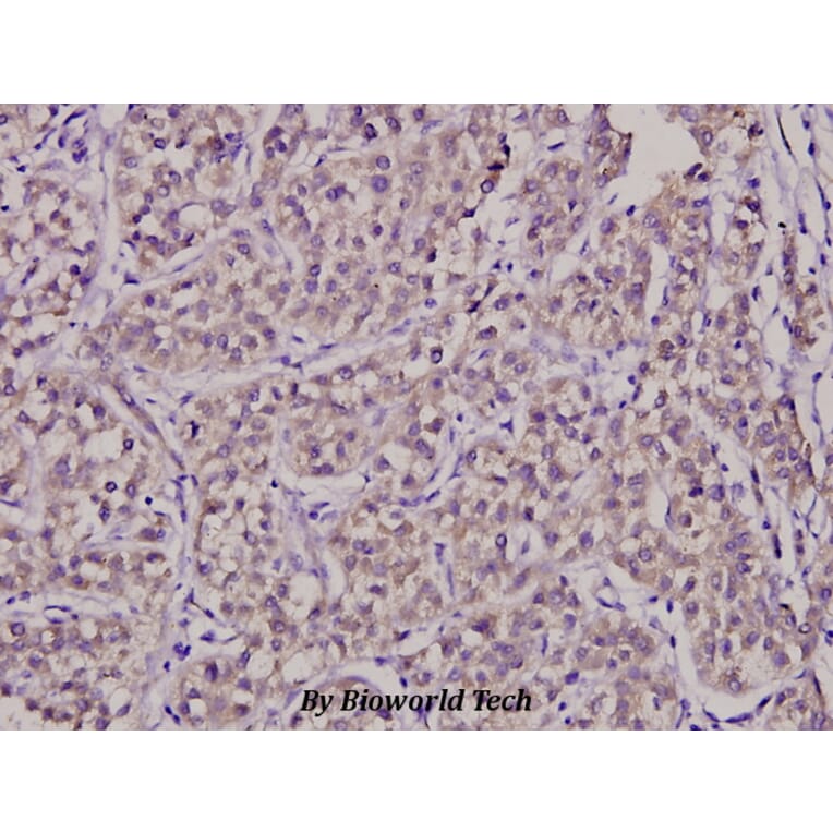 Anti-SURF-1 (F181) Antibody from Bioworld Technology (BS2068) - Antibodies.com