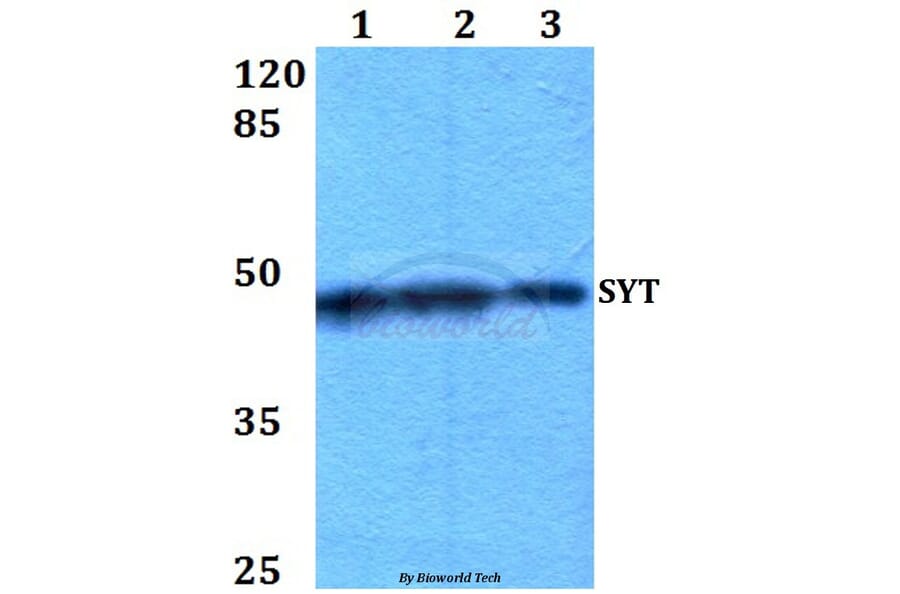 Anti-SYT (A7) Antibody from Bioworld Technology (BS2069) - Antibodies.com
