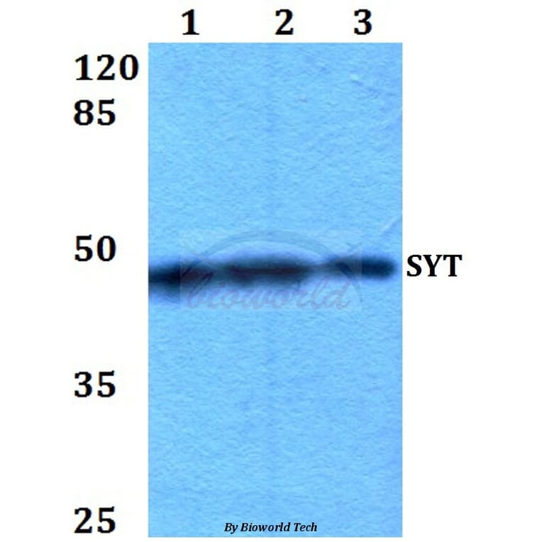 Anti-SYT (A7) Antibody from Bioworld Technology (BS2069) - Antibodies.com