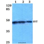 Anti-SYT (A7) Antibody from Bioworld Technology (BS2069) - Antibodies.com