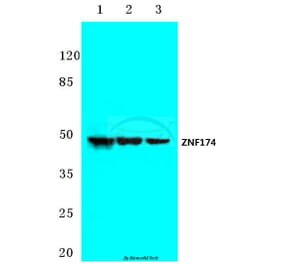 Anti-ZNF174 (E209) Antibody from Bioworld Technology (BS2073) - Antibodies.com