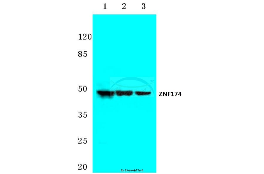 Anti-ZNF174 (E209) Antibody from Bioworld Technology (BS2073) - Antibodies.com
